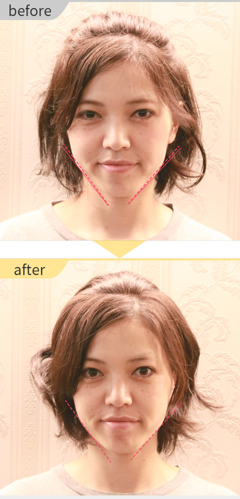 H.I.様のビフォーアフター写真
